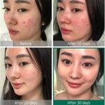 SOME BY MI AHA.BHA.PHA 30 Days Miracle Acne Clear Foam 50ml - Image 3
