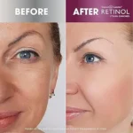 Retinol Advanced Brightening Skin Serum, 30ml - Image 3